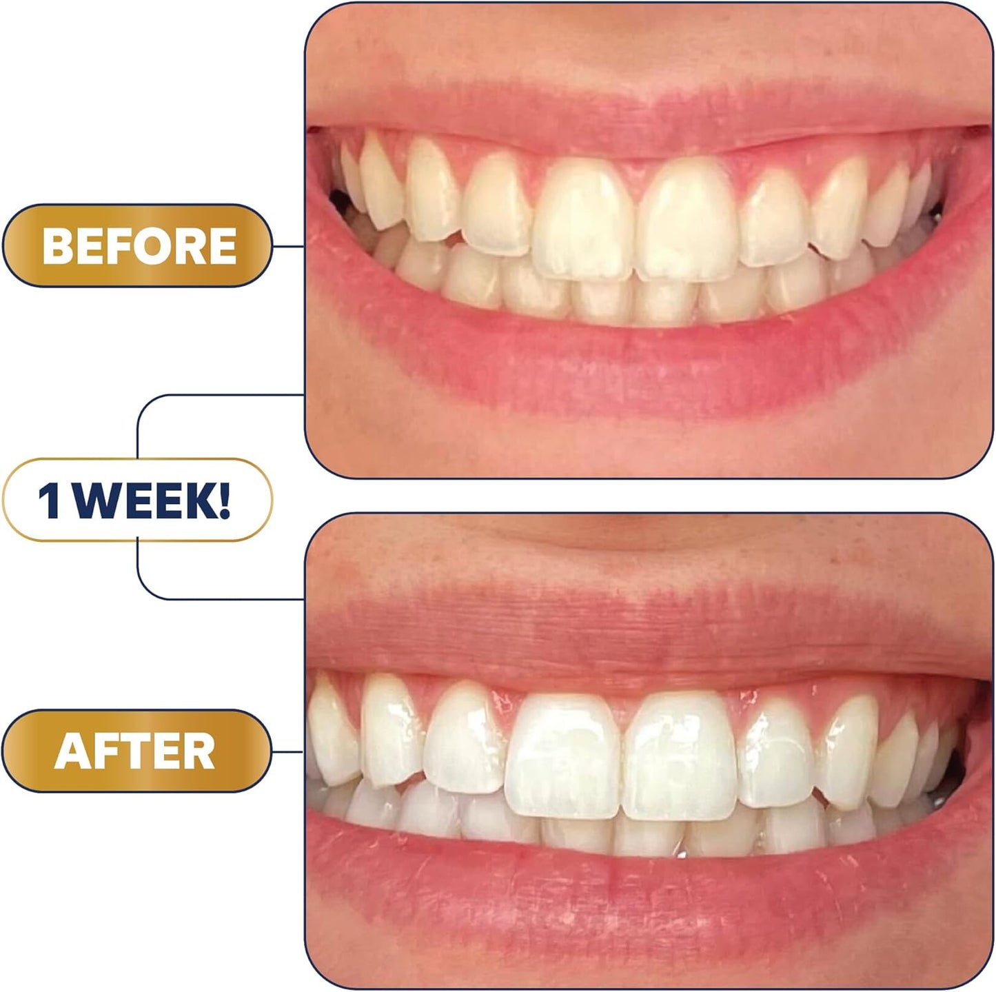 Lumineux Teeth Whitening Strips 9 Treatments – Peroxide Free - Enamel Safe for Whiter Teeth - Whitening Without The Sensitivity - Dentist Formulated - Sensitivity Free